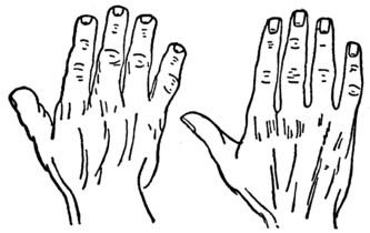 Plate I.—Part II. Fig. 1—THE ELEMENTARY HAND. Fig. 2—THE SQUARE OR USEFUL HAND. Fig. 3—THE SPATULATE HAND. Fig. 4—THE PHILOSOPHIC HAND.